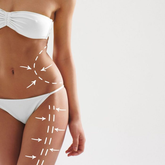 Body contouring