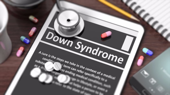 Down syndrome care